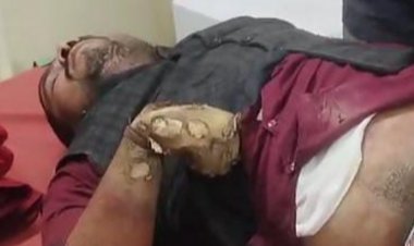 आगरा में महाकुंभ जा रही बस में आया करंट:हाईटेंशन लाइन से टच हुई बस, 40 श्रद्धालु से थे सवार, 4 की हालत गंभीर